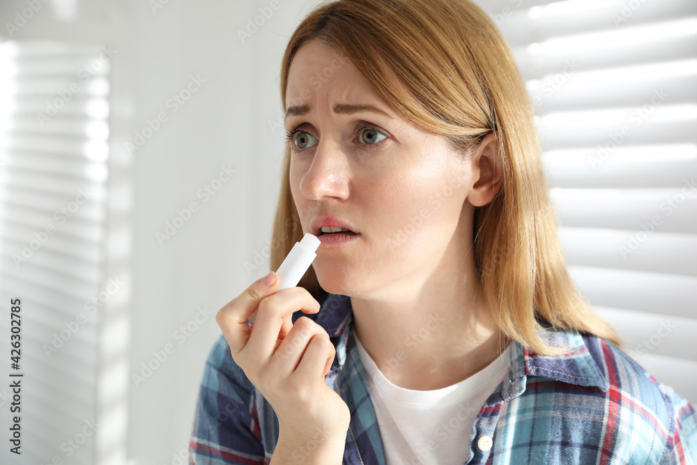 Upset woman with herpes applying lip balm indoors Upset woman with herpes applying lip balm indoors