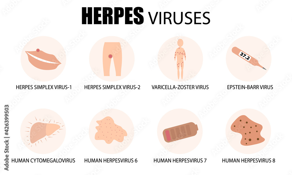 Herpes viruses. Classification, types, and symptoms of human herpes. Medical poster, banner. Vector flat illustration