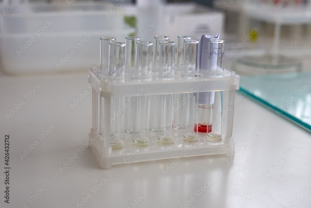 Medical test tubes are on the table. One test tube contains blood. Medical test tubes are on the table. One test tube contains blood.
