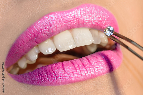 Dentist doctor select a gem or rhinestone for the patient’s teeth, Mouth close up