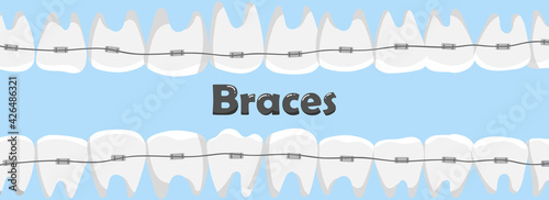 Human teeth with braces. dental care concept.