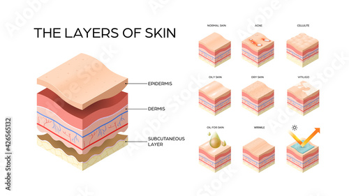 set different types skin layers cross-section of human skin structure skincare medical concept flat horizontal