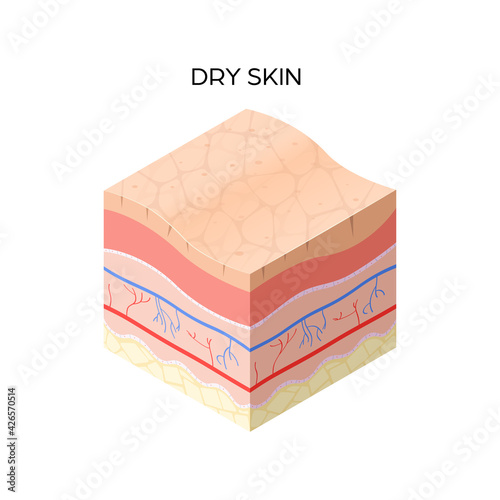 1R skin 1