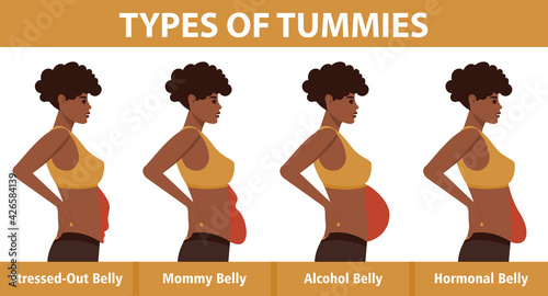 Four types of Tummies for African American women. Overweight woman side view. Problem areas on the stomach. Vector illustration isolated on white background.