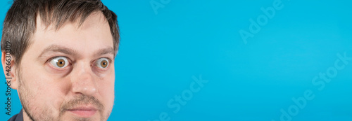 Surprised man bulging eyes on blue banner with place for text. Exophthalmos with hyperthyroidism or surprise in advertising due to discounts, sales in the store. photo