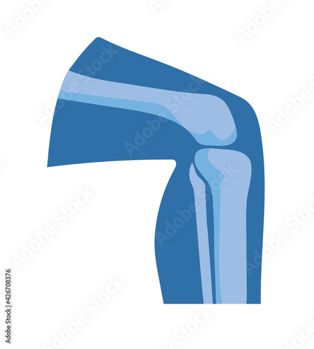 normal knee joints