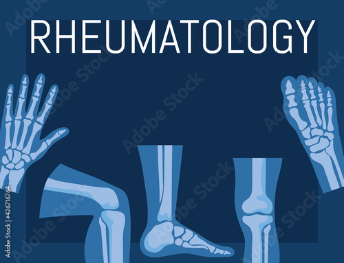 rheumatology bones poster