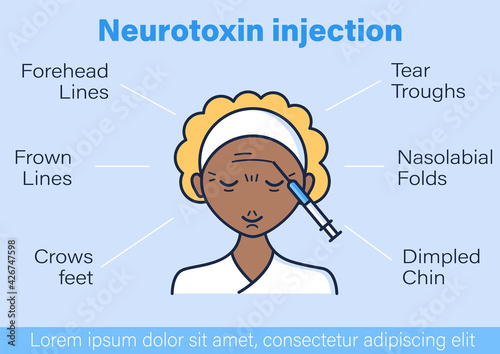 Cosmetic injection vector infographic.Neurotoxin.Beauty correction template design element. Face lifting variation. Rejuvenation. Cosmetic procedure layout, info chart, banner