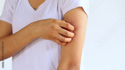 Young woman is scratching her arm on the white background.