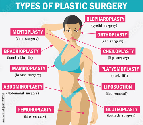 Medicine Plastic surgery infographics. Types of plastic surgery. Body and face plastic surgery infographics for posters and brochures. Vector elements and icons