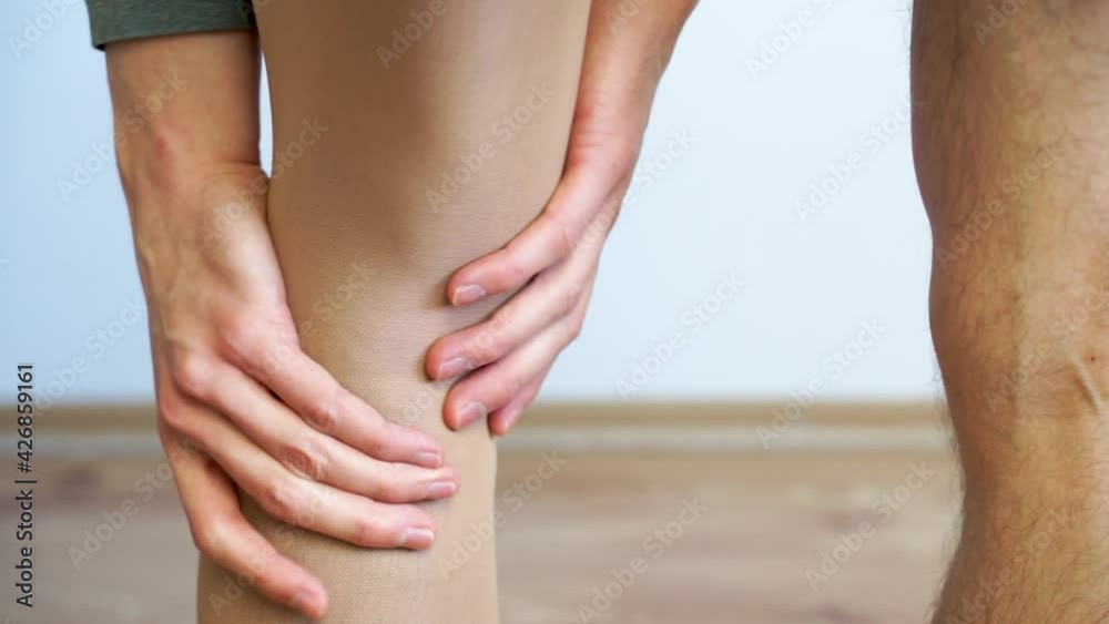 Painful varicose and spider veins on young male legs with compression stocking Painful varicose and spider veins on young male legs with compression stocking