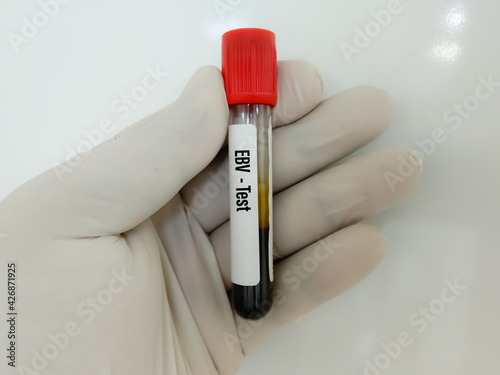 Blood sample for Virus Panel test, diagnosis for viral disease photo