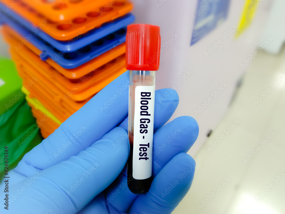 blood specimen i tube for blood gas test measures the acidity and the