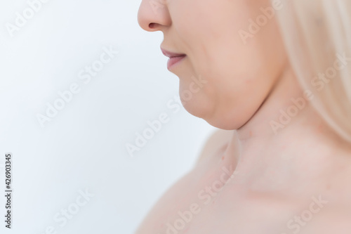 Closeup of woman's secong chin, problems with excess weight. Woman is touching her chin to demostrate her cosmetic problem. Examining double chin, need facial line correction photo
