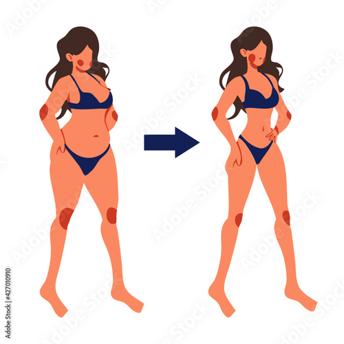 Before and after of woman exercise weight loss Fat and slim cartoon flat lifestyle vector illustration