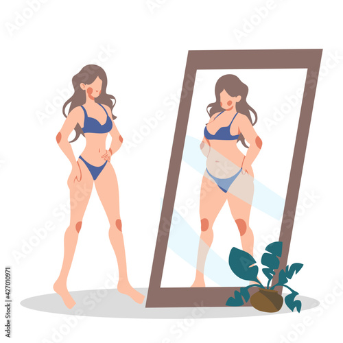 Woman body reflection of obesity in the mirror anorexia cartoon flat lifestyle vector illustration