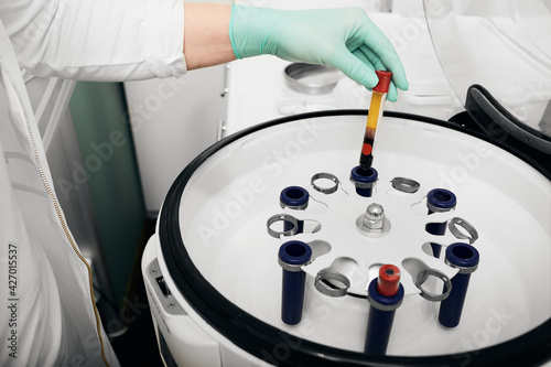 Preparation of blood plasma in a centrifuge for plasmolifting and cosmetic procedures for skin rejuvenation