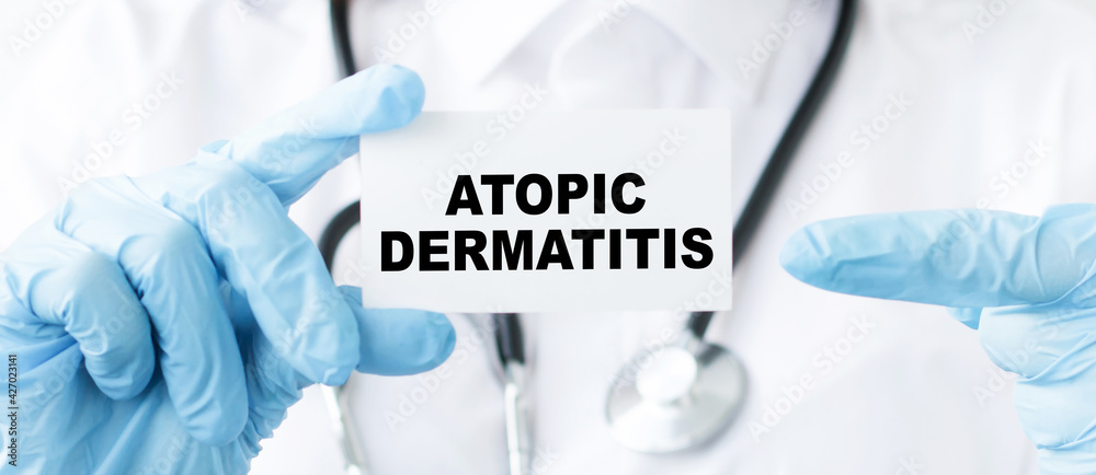 The doctor holds a business card with ATOPIC DERMATITIS