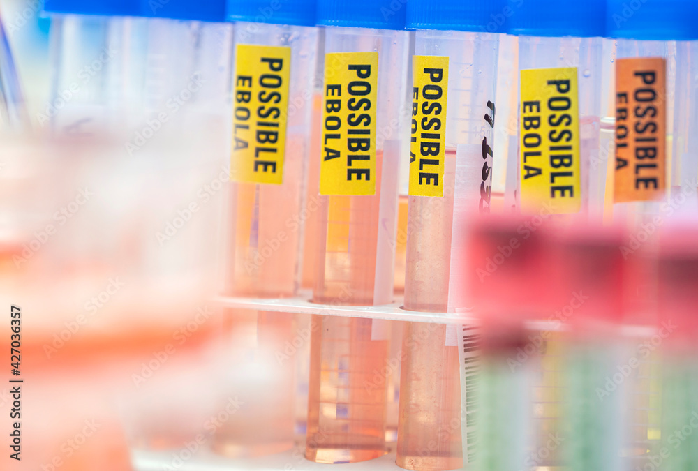 Sample vials of blood from possible Ebola patients infected with new Zaire strain of Ebola, concept image Sample vials of blood from possible Ebola patients infected with new Zaire strain of Ebola, concept image