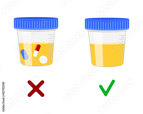 Urinalysis, urine samples with and without drugs. Doping control in sport, post accident drug testing concept. Vector cartoon illustration.