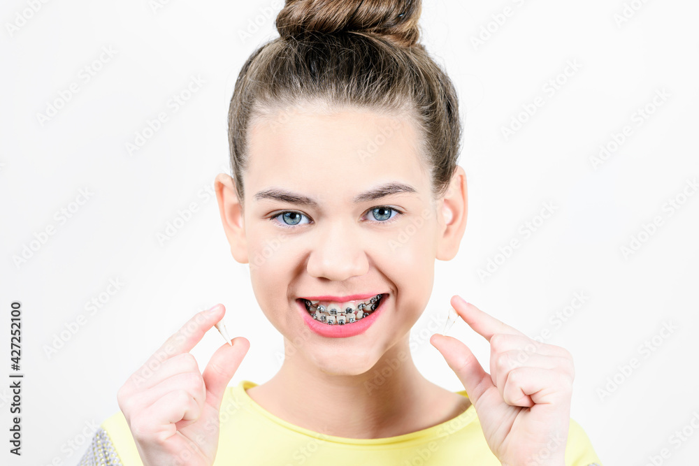 Girl with dental brackets holds digit teeth. Concept of dentistry and installation of braces. Girl with dental brackets holds digit teeth. Concept of dentistry and installation of braces.
