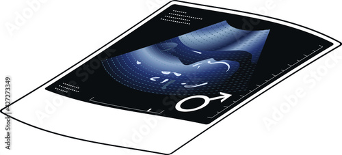Ultrasound photo of a fetus with a gender male symbol. Isometric projection.