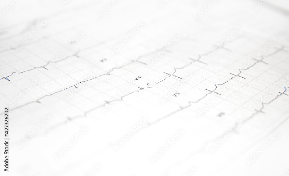 a card with a cardiogram of the heart. High quality photo a card with a cardiogram of the heart. High quality photo