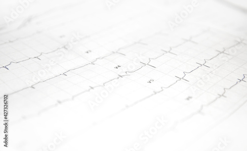 a card with a cardiogram of the heart. High quality photo