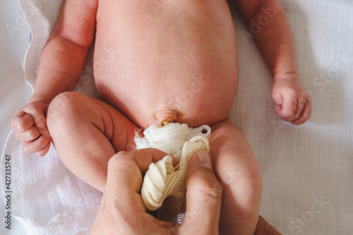 Hands of unknown man father caring for umbilical cord with clamp and bandage of newborn baby neonatal care parent clean navel of baby on bed at home