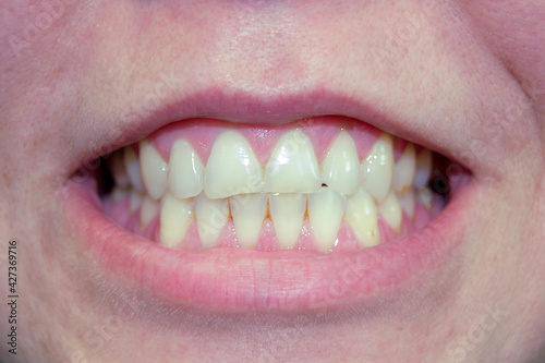 female smile close up. female lips without lipstick. human teeth