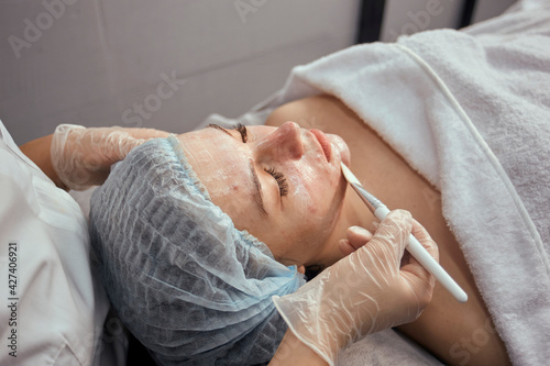 The hands of a cosmetologist in gloves are applied to the face of a female client with acne gel brush. Professional skin care.