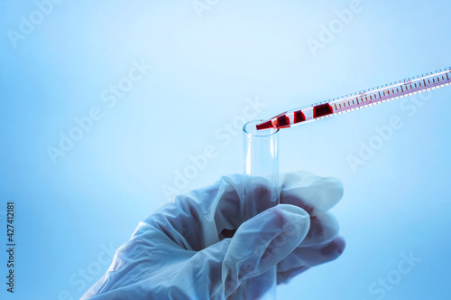 Medical laboratory. A hand in a medical glove pours blood from a pipette into an empty test tube on a blue background. Laboratory tests.