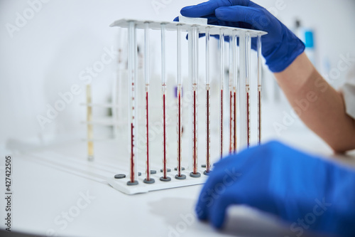Biochemist examining a set of calibrated pipettes