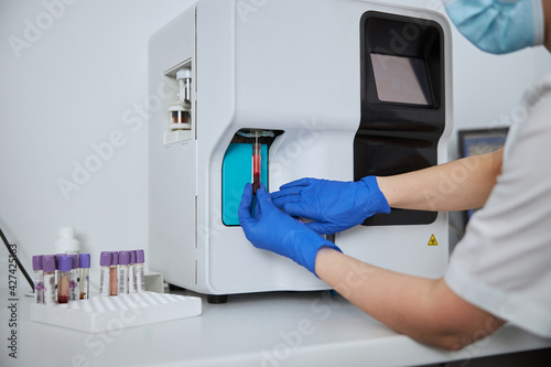 Lab technician carrying out a hematological test