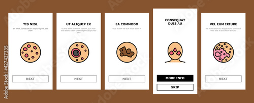 Skin Disease Symptom Onboarding Mobile App Page Screen Vector. Skin Cancer And Acne, Vitiligo And Bruise, Eczema And Chronic Blistering, Herpes And Mycosis Illustrations