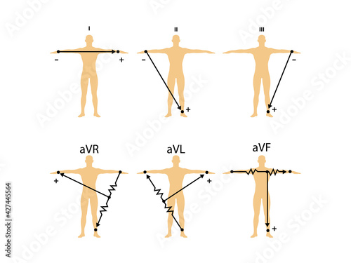 Einthoven ECG triangle, including augmented unipolar limb lead