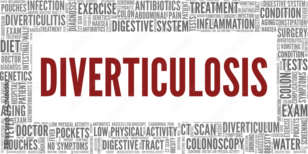 Diverticulosis vector illustration word cloud isolated on a white background.