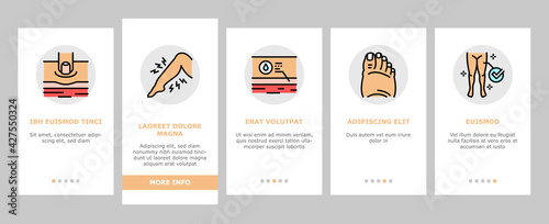 Edema Disease Symptom Onboarding Mobile App Page Screen Vector. Venous And Fatty, Lymphatic And Hypoproteinemic, Allergic And Heart Edema Health Problem Illustrations