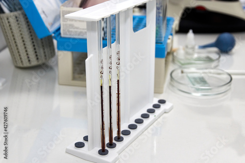 Serological capillary pipettes with blood samples for analysis photo