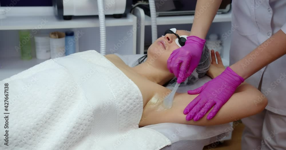 Applying gel under the armpit before laser hair removal. Applying gel under the armpit before laser hair removal.