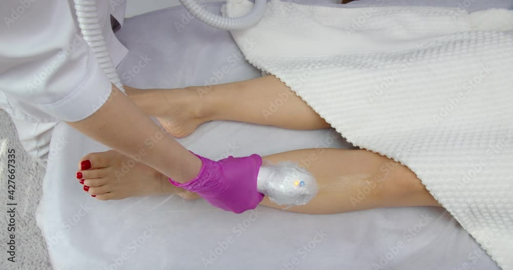 Beautician removes hair on beautiful female legs using a laser. Beautician removes hair on beautiful female legs using a laser.