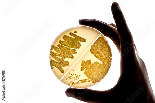 Laboratory technician tests for bacterial infection analyzes bacterial colonies growth Lab worker's hand holds test sample in Petri dishes