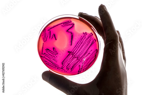 Laboratory technician tests for bacterial infection analyzes bacterial colonies growth Lab worker's hand holds test sample in Petri dishes