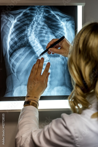 Konstfotografi Blonde female physician looking at a patients x-ray