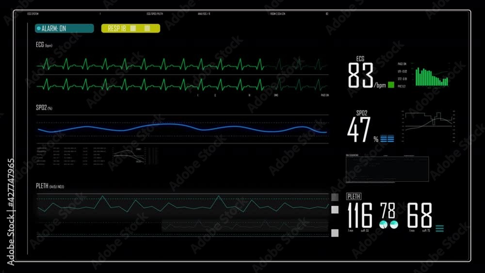 Electrocardiogram ECG background animation display Electrocardiogram ECG background animation display