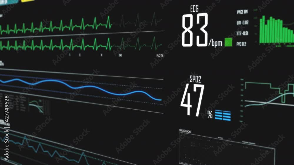 Flight over medical ECG electrocardiogram screen measuring device with heart rate, pulse, health data. Digital background animation.