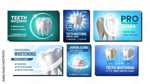 Teeth Whitening Promotional Posters Set Vector. Professional Teeth Whitening Dentist Clinic Procedure Collection Of Advertising Banners. Dental Care Style Concept Template Illustrations