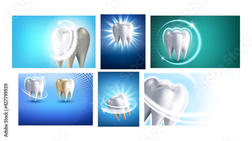 Teeth Whitening Promotional Posters Set Vector. Professional Teeth Whitening Dentist Clinic Procedure Collection Of Advertising Banners. Dental Care Style Concept Template Illustrations
