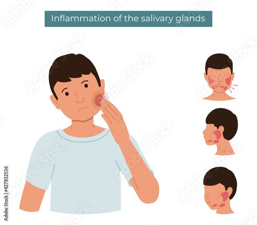 Vector flat illustration of a person with inflamed salivary glands. The guy feels pain in the salivary gland.