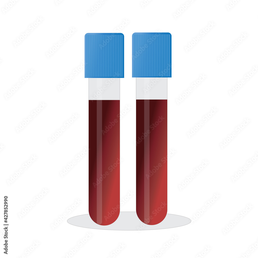 test tubes with blood and a container with urine test tubes with blood and a container with urine